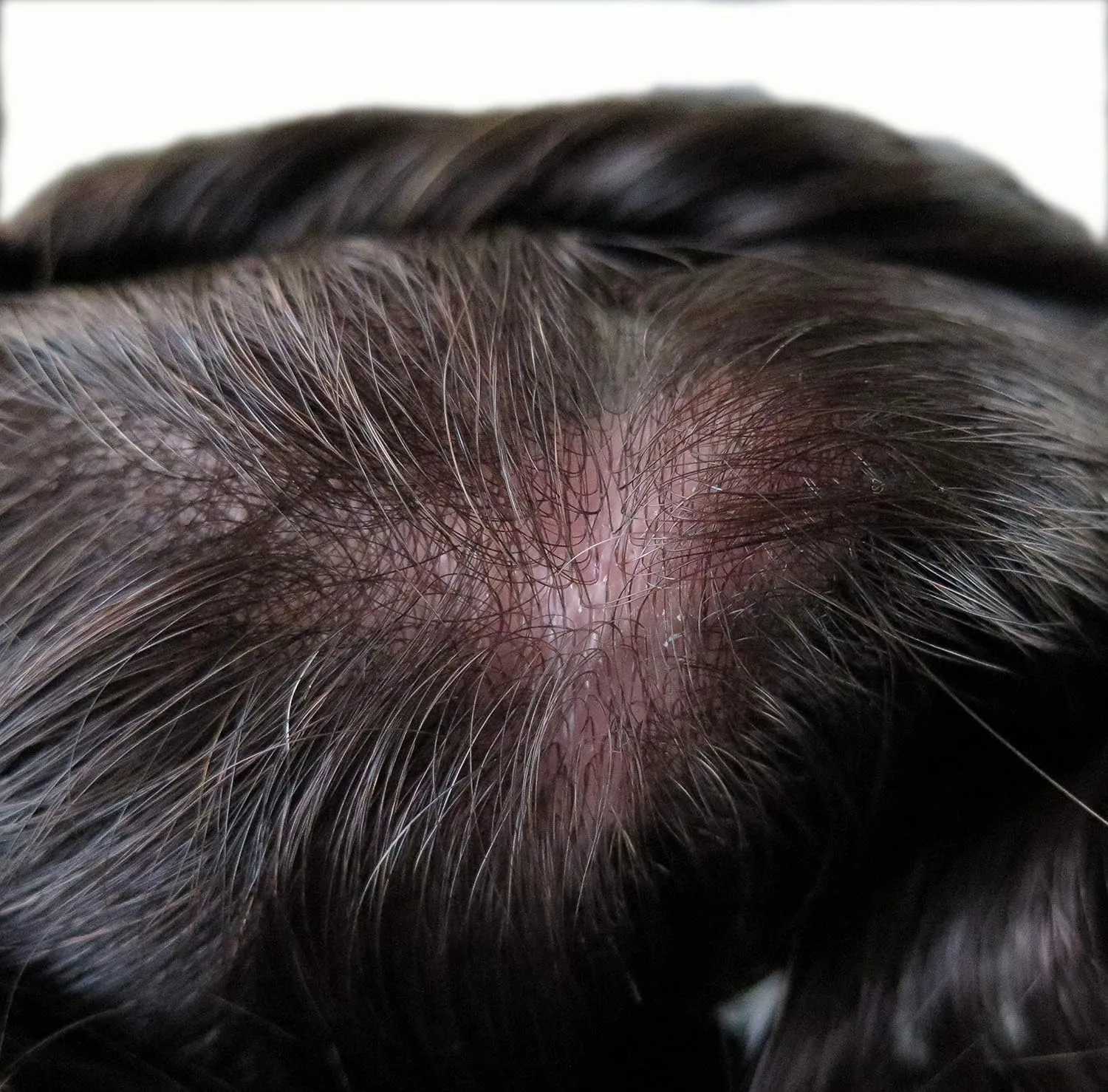Toupee for Men's Hair Pieces Human Hair Replacement Systems Ultra Thin Skin V Looped Black Hair Unit #1C